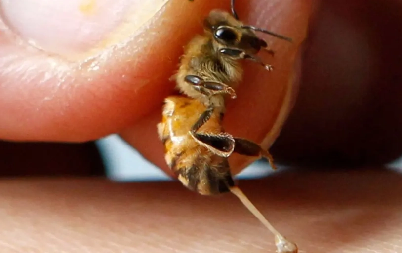 蜂叮急救 蜂叮急救